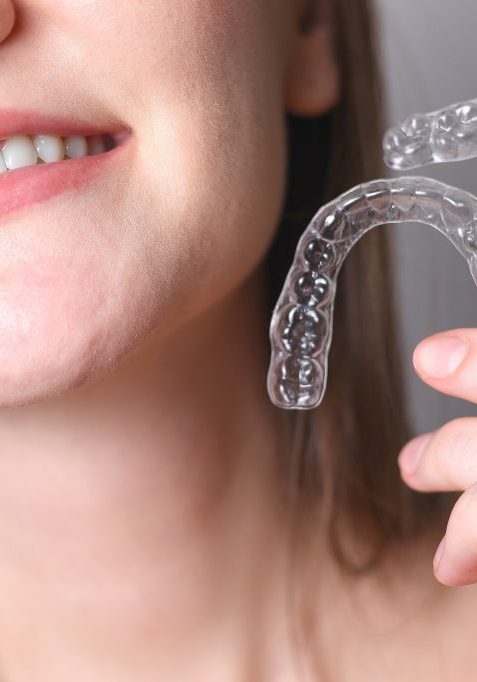 Clear Aligners in Sunnyvale